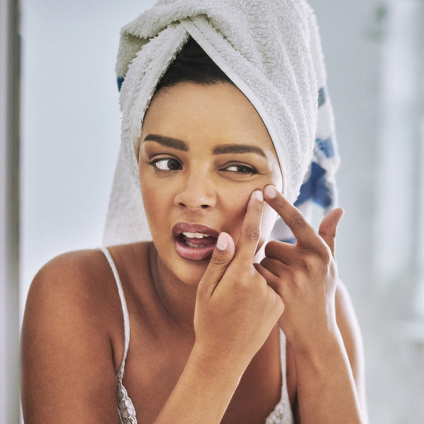 Acne Prone Skin