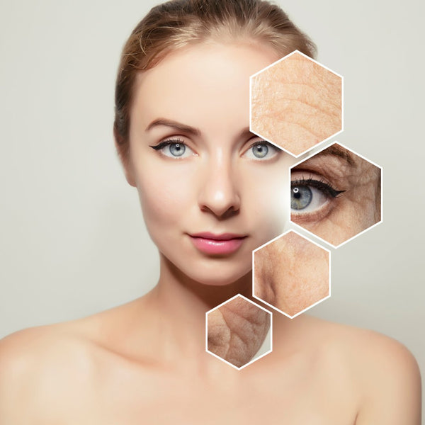 Anti-Aging