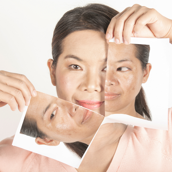 Dark Spots