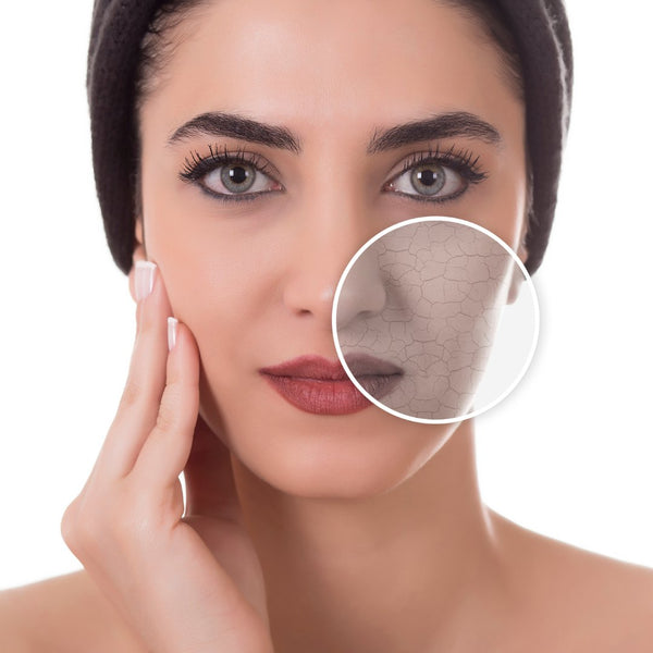 Dry Skin
