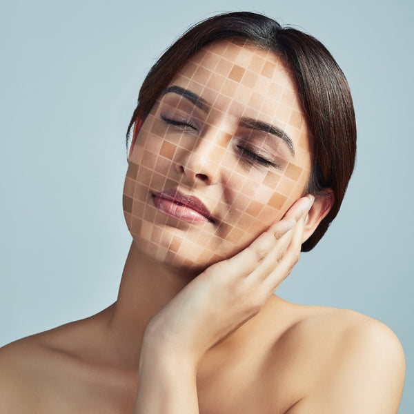 Uneven Skin Tone